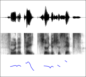 Spectrogram