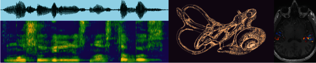 Speech processing collage